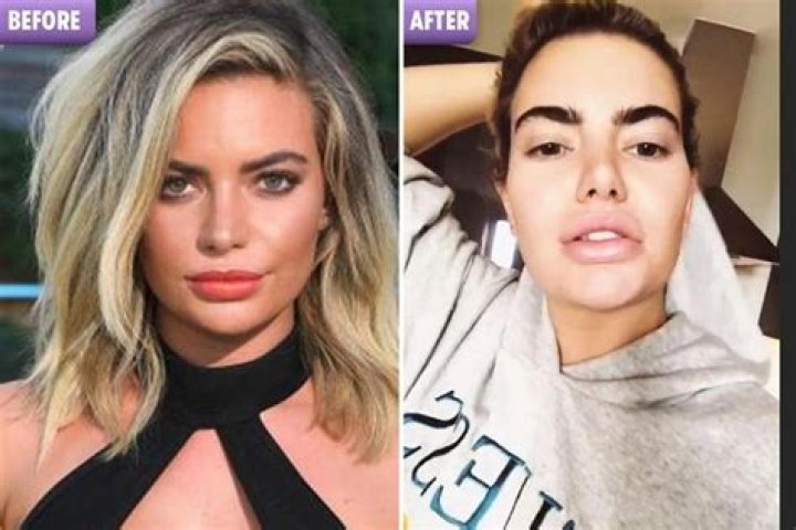 
Megan Barton Hanson Before Plastic Surgery Photos- Love Island Star Details To Know 